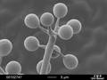 Sporangiophore Plasmopara viticola Aus den seltsamen Kugeln (Sporangien) schlüpfen bewegliche Sporen, die Weinblätter infizieren und den falschen Mehltau auslösen. (1:2000 scanning electron microscopy, ZMB Basel, WBI Freiburg)